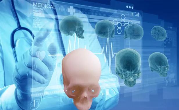 3D打印在面頜修復中的應用 3D打印在面頜修復中的應用