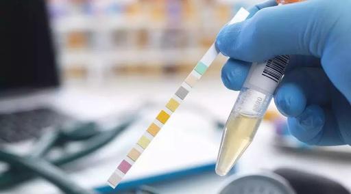 現(xiàn)場(chǎng)快速檢測(cè) 現(xiàn)場(chǎng)快速檢測(cè)