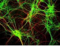 芯片實驗室和細胞生物學 芯片實驗室和細胞生物學